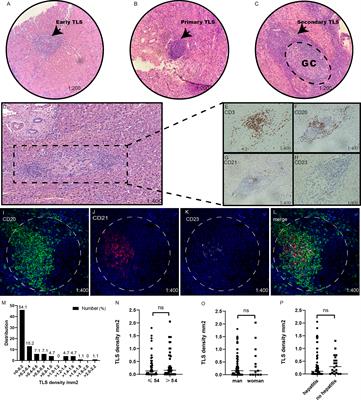 Combination of Tertiary Lymphoid Structure and Neutrophil-to-Lymphocyte Ratio Predicts Survival in Patients With Hepatocellular Carcinoma